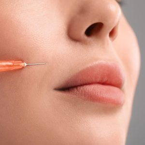 La innovadora microcánula como alternativa para quitar el surco nasogeniano