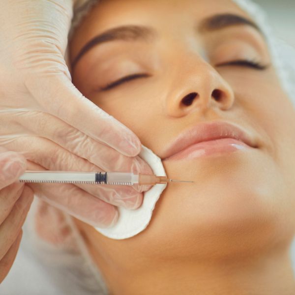 Sculptra tratamiento médico estético con estimuladores de colágeno