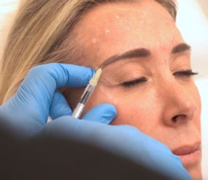 Sculptra Inductores-de colágeno para el rejuvenecimiento facial