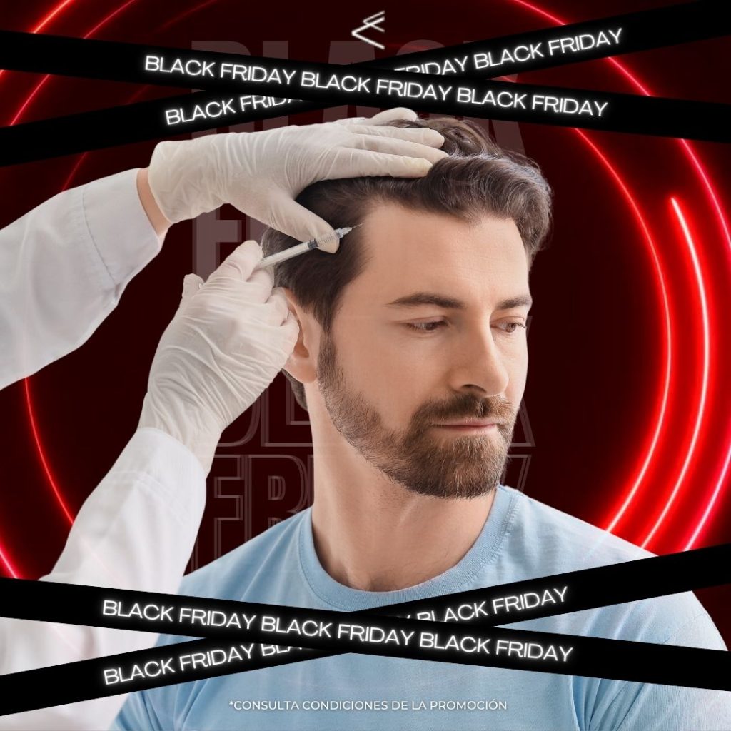 PRP Capilar black friday en Clinica Medicina Estetica Sevilla