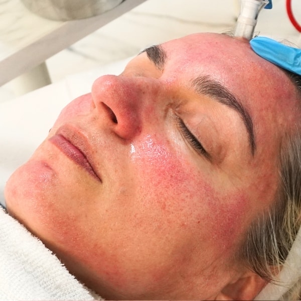 limpieza facial profunda sevilla beneficios limpieza-facial-profunda-sevilla-beneficios