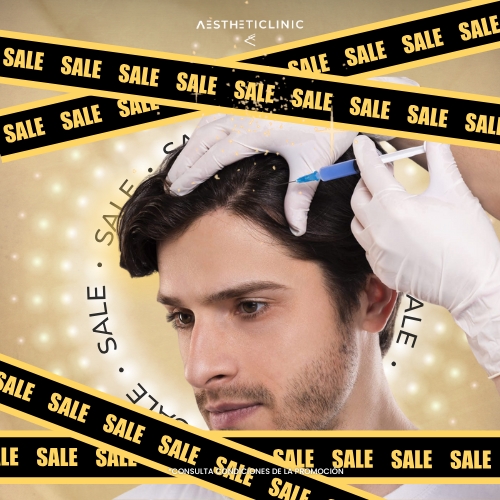 PRP capilar sevilla en la clínica medicina estética aesthticlinic