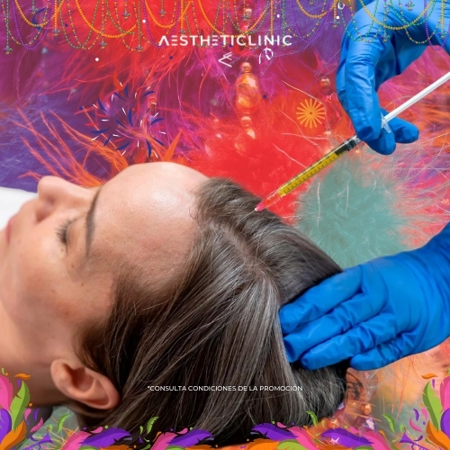 PRP Capilar en Sevilla PRP Capilar en Sevilla